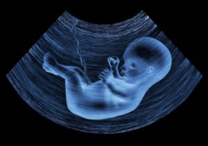 ultrasound image of baby in mother's womb